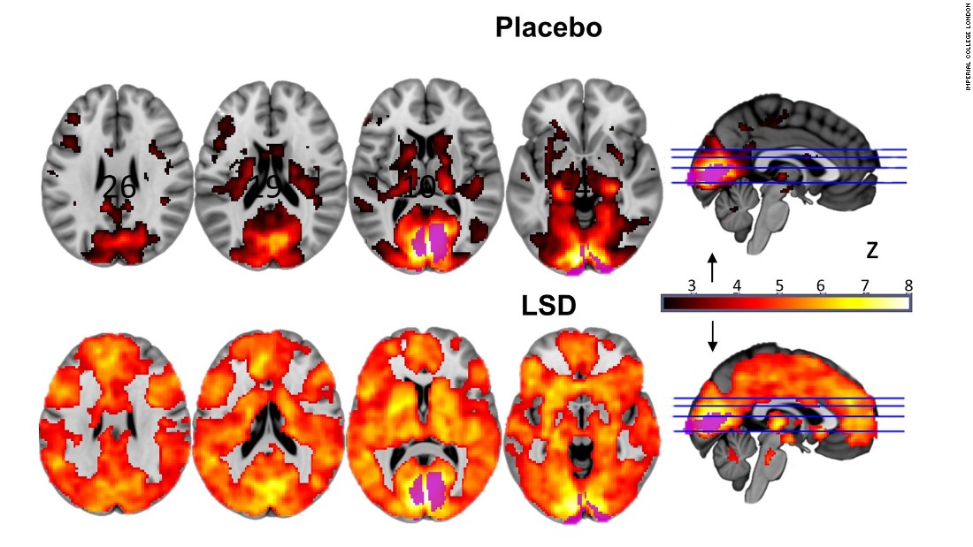 Participants&#39; brains lit up with activity after taking the drug. Researchers hope the findings may help towards developing treatments for depression or addiction. 