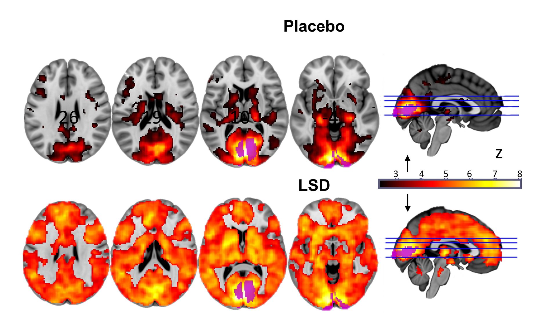 Does acid work how How LSD