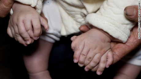 Äiti näyttää poikansa käsiä. Hänellä on 15 sormea, kaksi kämmentä kummassakin kädessä eikä peukaloita. 