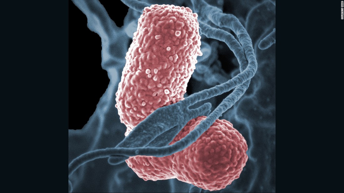 Klebsiella bacteria have also developed a high level of resistance to antibiotics, such as &lt;a href=&quot;http://www.cdc.gov/hai/organisms/cre/index.html&quot; target=&quot;_blank&quot;&gt;carbapenem&lt;/a&gt;. The bacteria naturally occurs in the intestines where it does not usually cause disease, but it can cause pneumonia, bloodstream infections and meningitis.&lt;br /&gt;&lt;br /&gt;It&#39;s unlikely that healthy people are affected by the bacteria, but &lt;a href=&quot;http://www.cdc.gov/HAI/organisms/klebsiella/klebsiella.html&quot; target=&quot;_blank&quot;&gt;patients in hospitals&lt;/a&gt; who use a ventilator, intravenous catheters or long courses of certain antibiotics are at higher risk of becoming infected. 