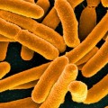 Enterobacter or E. coli