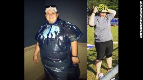 Fulfilling goals of a lifetime, with help from bariatric surgery