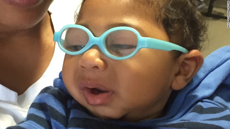 A mother and her baby, who has microcephaly, at the Altino Ventura Foundation Clinic in Recife, Brazil.