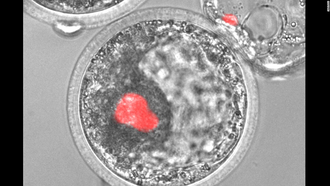 This microscopic image shows human induced pluripotent stem cells, colored red, integrated into a pig embryo. Scientists hope these human cells can be harnessed to create organs for transplant patients one day.