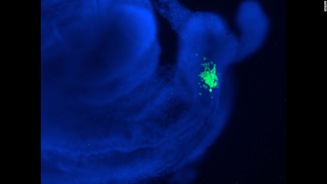 In this human-mouse chimeric embryo, the human stem cells are shown in green and mouse cells are blue. Early in the research, scientists focused on integrating human cells into mouse embryos. However, pigs are now a preferred animal because their organs are roughly the same size as humans&#39;.