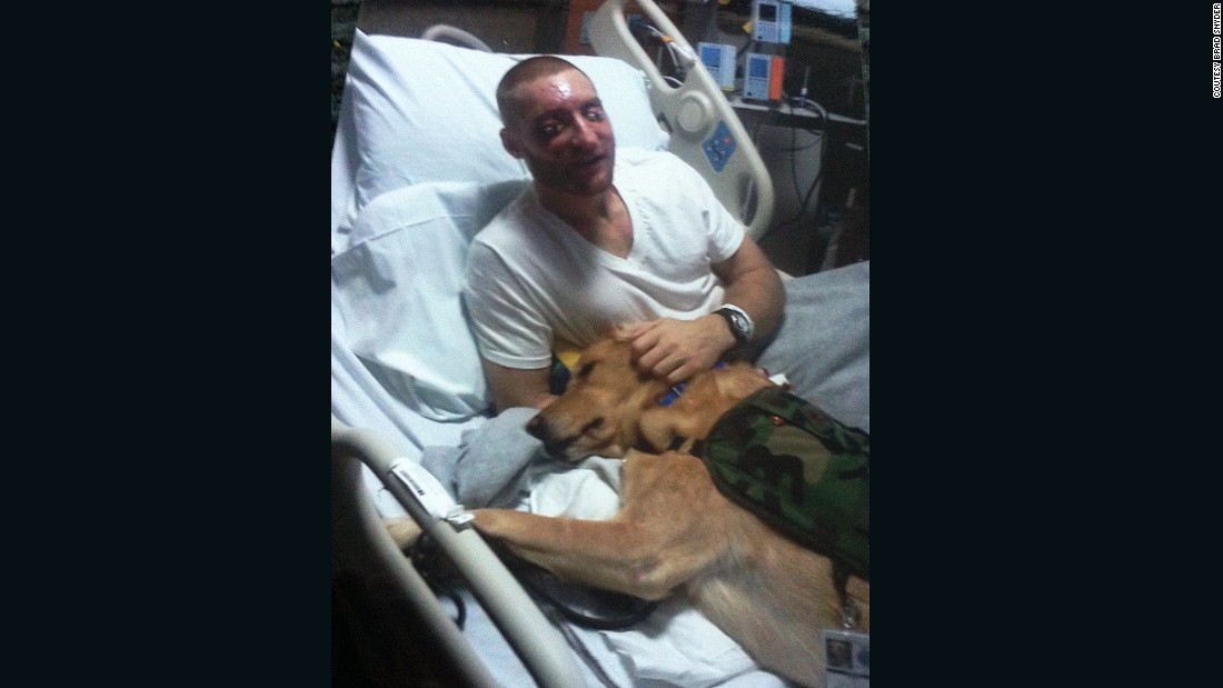 Snyder, then 27, lost his sight and had multiple operations on his face and eyes. From then on, he relies on his service dog, Gizzy, to guide him on the streets of Baltimore, where he now lives.