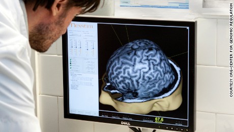 Testing of new Alzheimer&#39;s drug disappoints, but it&#39;s not all bad news 