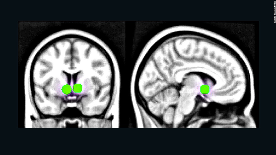 Being appreciated on social media, through &quot;likes,&quot; was seen in brain scans to activate the reward centers of the brain, pictured.