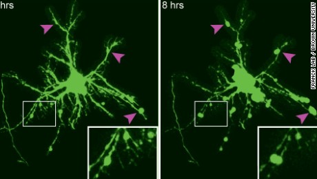 What a concussion looks like in the brain, on the cellular level