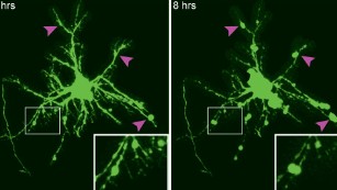 Is Concussion Associated with Abnormal Menstrual Patterns in Young Women? -  Neuroscience News