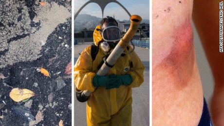 Polluted water, Zika and superbugs are three of the major health concerns at the Rio Olympics.