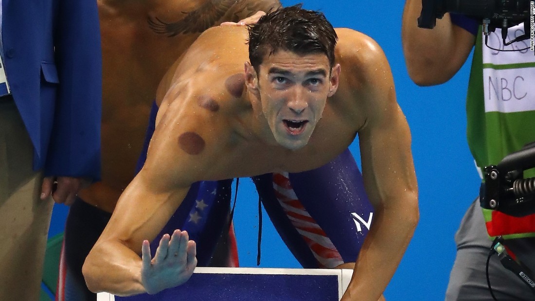 U.S swimmer Michael Phelps competes in the 4x100-meter freestyle relay on Sunday, August 7. The red marks on his body are &lt;a href=&quot;http://www.cnn.com/2016/08/08/health/cupping-olympics-red-circles/index.html&quot; target=&quot;_blank&quot;&gt;the result of cupping&lt;/a&gt; -- an ancient therapy that has mostly been used in Middle Eastern and Asian countries, especially China.