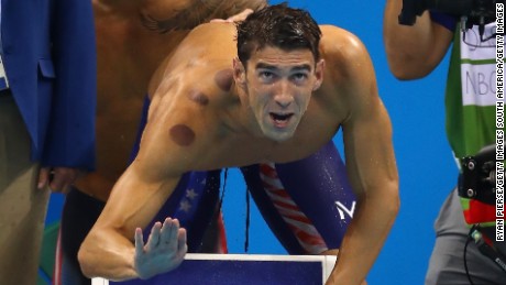 So, does Michael Phelps believe in flossing?