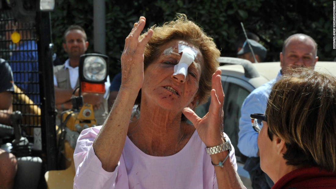 This woman in Amatrice was wounded during the earthquake.