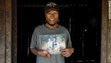 &#39;My friends were afraid of me&#39;: What 80 million unexploded US bombs did to Laos