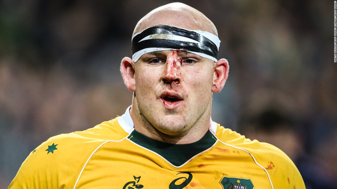 Stephen Moore of the Wallabies leaves the field with blood on his face during the Rugby Championship match between the New Zealand All Blacks and the Australia Wallabies at Westpac Stadium on August 27, 2016 in Wellington, New Zealand. 