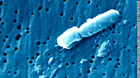 This scanning electron micrograph, SEM, revealed some of the ultra structural morphologic features of a Klebsiella pneumoniae bacterium. K. pneumoniae is a non-motile, Gram-negative rod, and a facultative anaerobe, which means that it is able to adapt to 