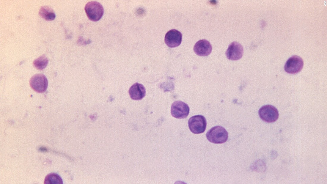 The fungus &lt;a href=&quot;https://www.cdc.gov/fungal/diseases/pneumocystis-pneumonia/&quot; target=&quot;_blank&quot;&gt;&lt;em&gt;Pnuemocystis jirovecii&lt;/em&gt;&lt;/a&gt; can also cause severe infections, particularly in people with HIV/AIDS. It caused one of the main AIDS-defining illnesses in the United States after the epidemic started in the 1980s.
