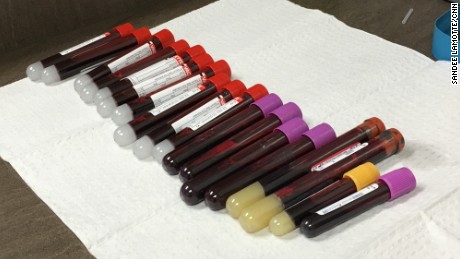 Eighteen vials of blood are drawn before the first injection, and half are frozen for future use.