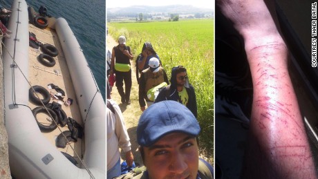 Left: A boat similar to the one Batal took from Turkey to Greece. Center: Walking through Greece to the Macedonian border. Right: The young man&#39;s legs covered in scratches after attempting to scale a razor wire fence into a Calais train station. 