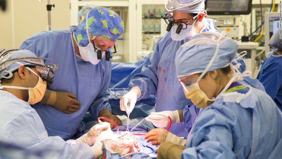 Dr. James Goodrich Goodrich, left, leads a surgical team as they prepared to separate the twins. &quot;Failure is not an option,&quot; Goodrich told the team as they got started.
