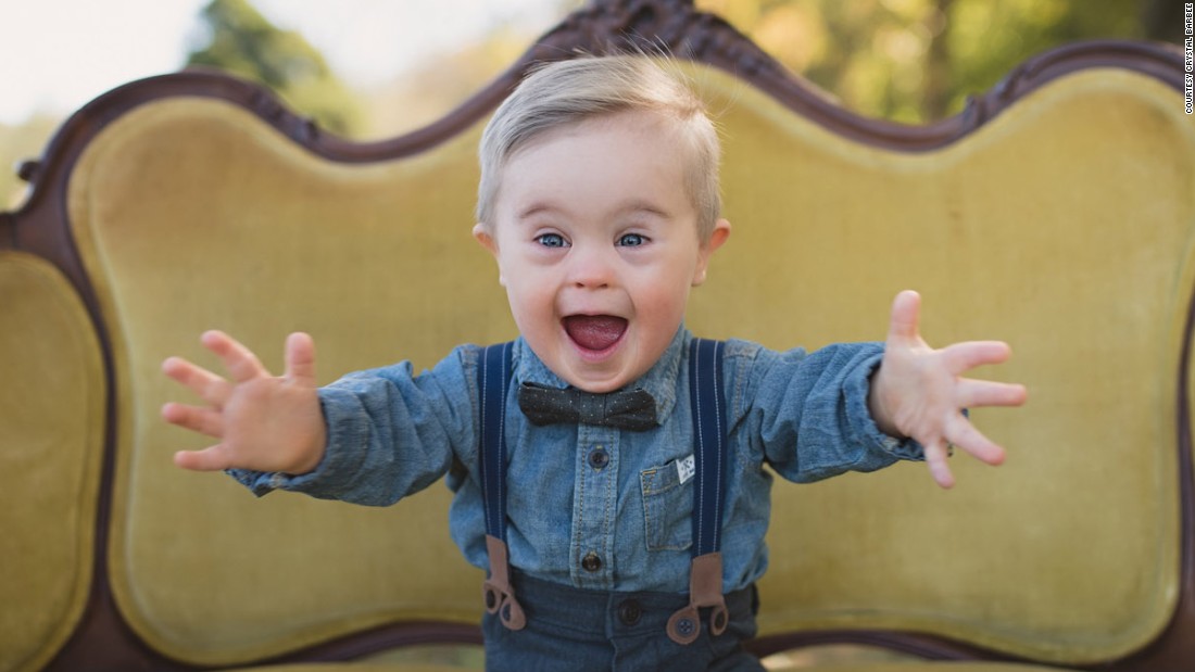 Toddler With Down Syndrome Lands Modeling Gig CNN Video