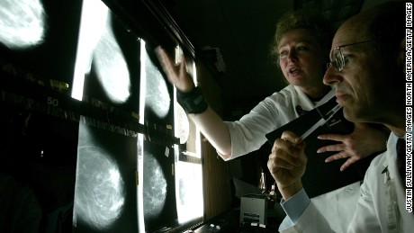 Women&#39;s cancer deaths expected to rise 60% by 2030