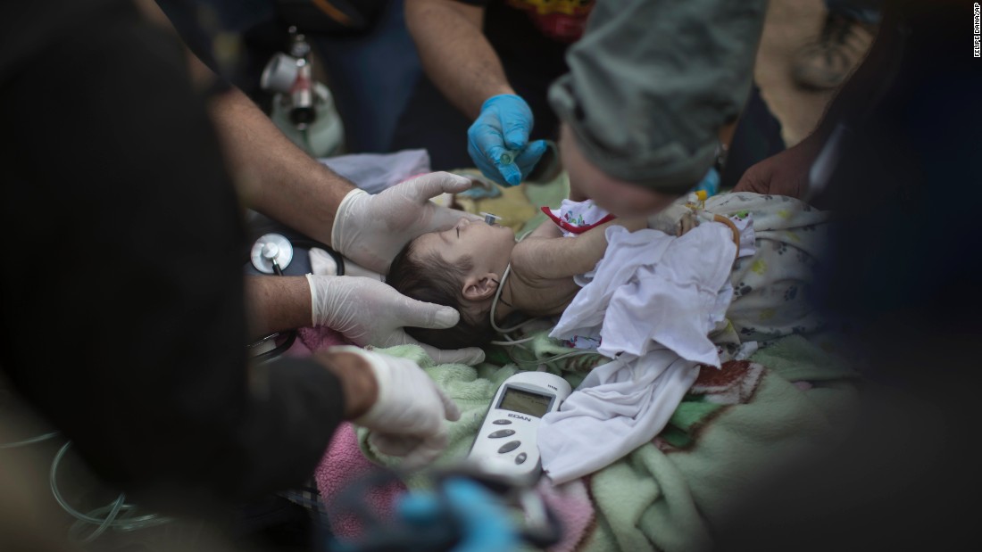 An injured baby receives treatment at a field hospital in Mosul on November 15.