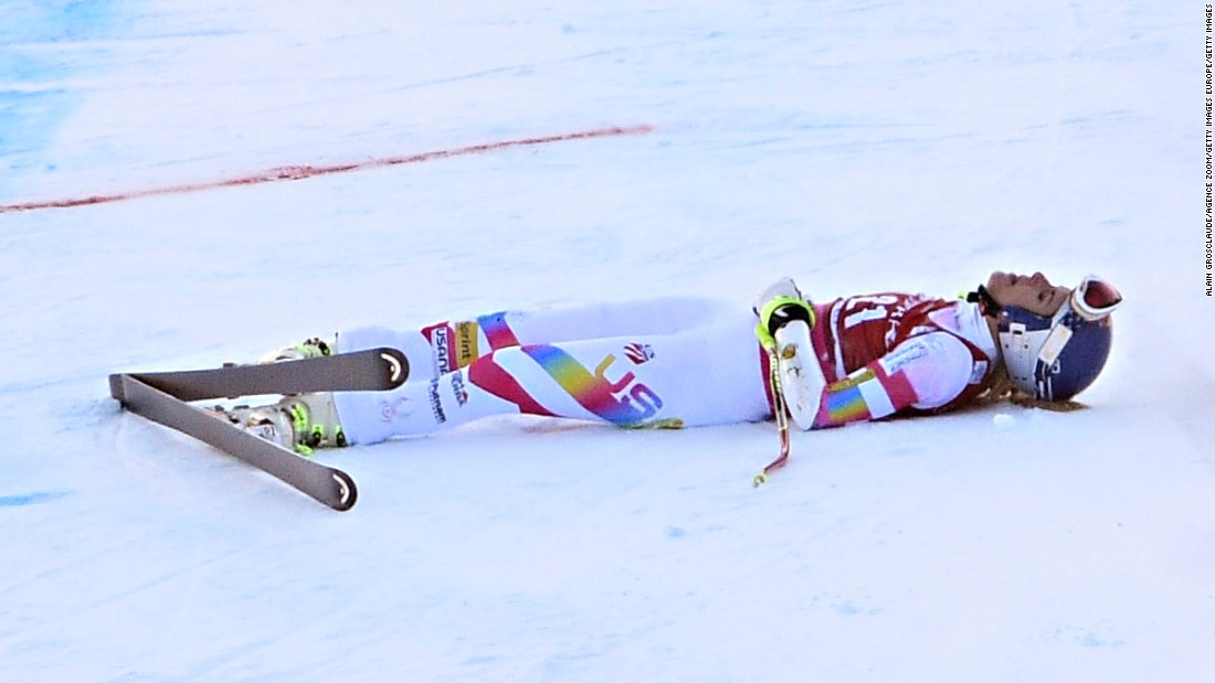 The life of a professional skier is far from easy. Lindsey Vonn, whose 2016-17 season has been interrupted after she suffered a broken arm in training, crashes at the women&#39;s super giant slalom in Val d&#39;Isere, France. But injuries and crashes aren&#39;t the only problems skiers face ...