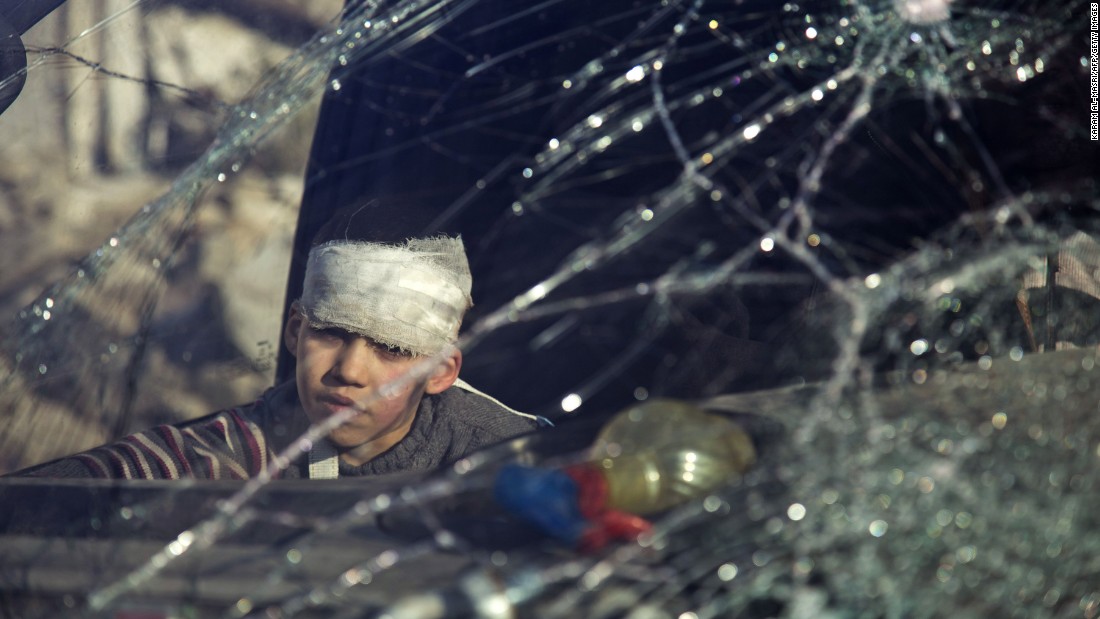 A wounded boy sits inside an ambulance during the evacuations on December 15.