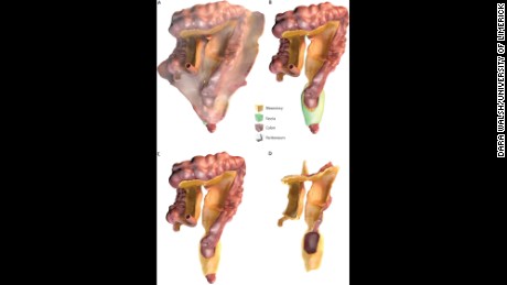 hoe het mesenterium functioneert in uw lichaam. (A) buikvlies, mesenterium, fascia en darm. B) mesenterium, fascia en darm. C) mesenterium en darm. D) Mesenterium.