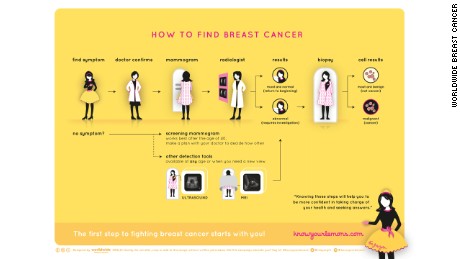 Detecting and diagnosing breast cancer may involve a number of steps.