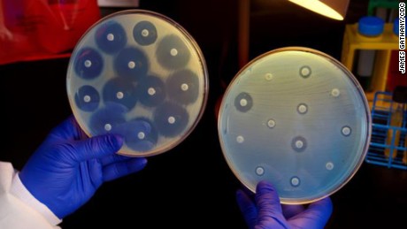 Superbugs kill 33,000 in Europe every year