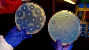 Superbugs kill 33,000 in Europe every year