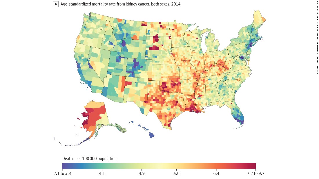 Deaths from kidney cancer in 2014 were highest in Alaska, Texas, Louisiana, Oklahoma and the Dakotas. Deaths were lowest in parts of Florida and Colorado.