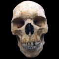 01 medieval pilgrim leprosy skeleton