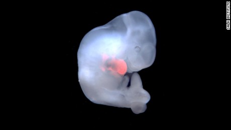 First human-pig embryos made, then destroyed 