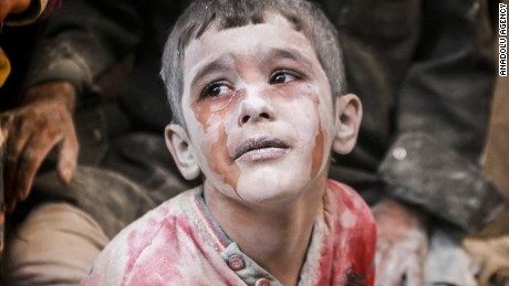 A wounded Syrian boy cries after Russian airstrikes on an Aleppo neighborhood in October 2016.