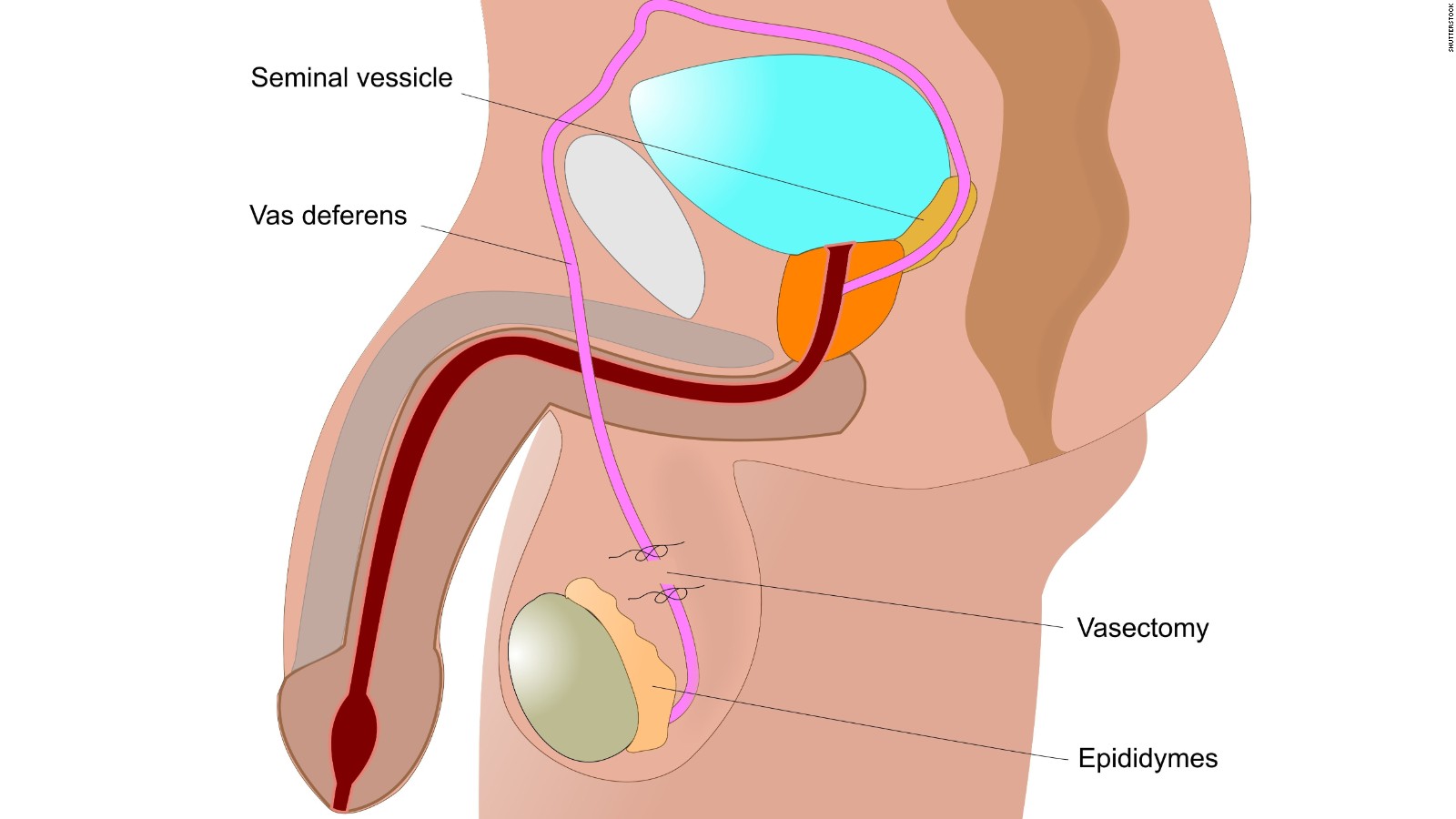 male-birth-control-shot-found-effective-but-side-effects-cut-study