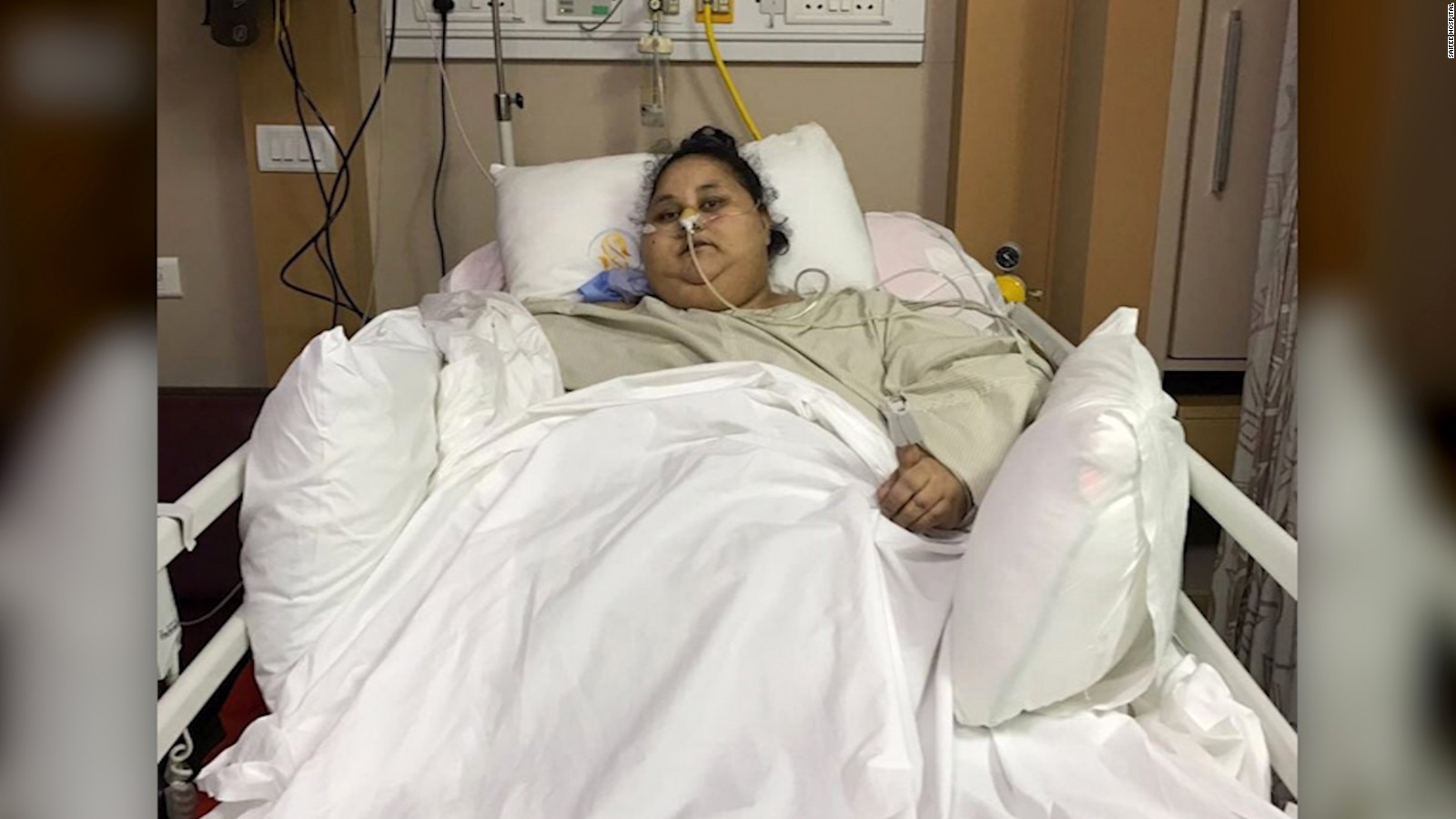 World S Heaviest Woman Gets Hope From Surgery CNN Video