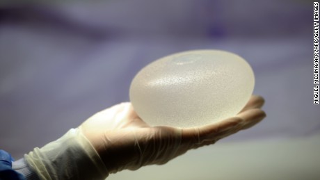 A picture taken on January 12, 2012 in Boissy-l'Aillerie, northern Paris, shows a technician presenting a silicone breast implant produced by French implant manufacturer, Sebbin laboratories.  Around 300,000 women in 65 countries have received implants made by Poly Implant Prothese (PIP), a now-defunct manufacturer in southern France that is at the centre of the storm, although some figures are much higher.  AFP PHOTO MIGUEL MEDINA        (Photo credit should read MIGUEL MEDINA/AFP/Getty Images)