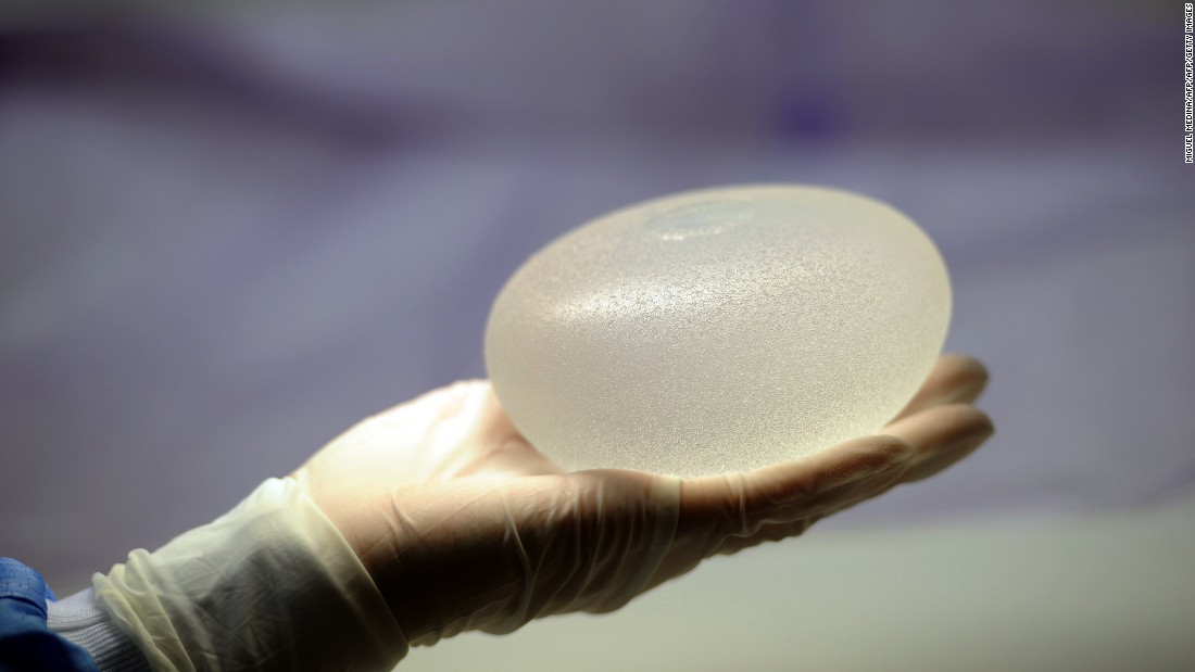 FDA recommends boxed warning for breast implants - CNN