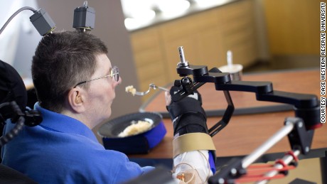 Een verlamde man gebruikt een experimenteel apparaat om handbewegingen te herstellen  
