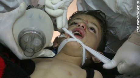 Why children get killed with barrel bombs and chemical attacks