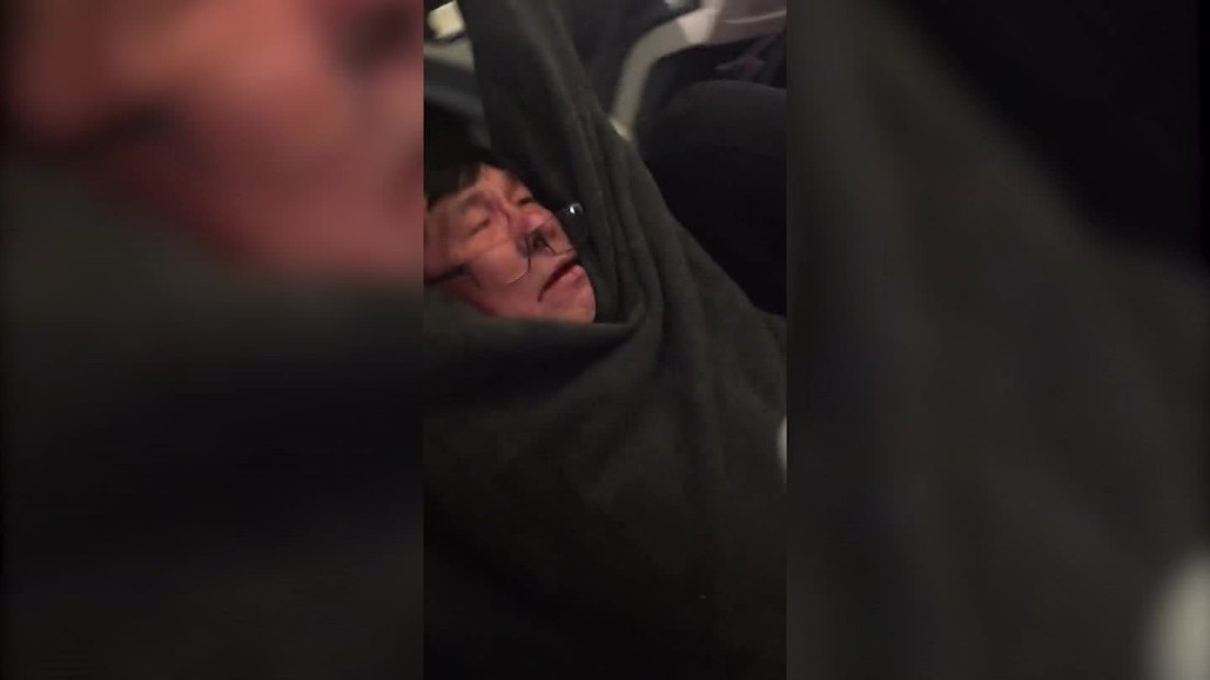 United Passenger Fiasco What We Know Cnn Video