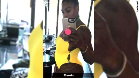 Serena Williams is definitely pregnant 