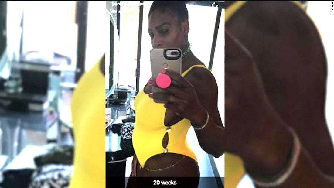 Williams had posted a side profile shot of herself in a yellow swimsuit on Snapchat with a caption that read &quot;20 weeks&quot; before deleting it, later revealing she did not mean to post the picture. 