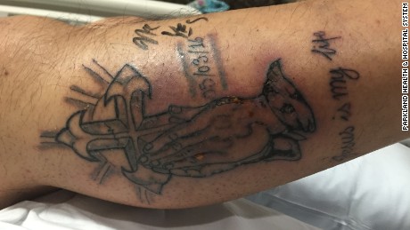 Man dies after swimming with new tattoo