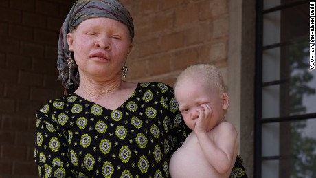 Songs from Tanzania&#39;s island of albinos