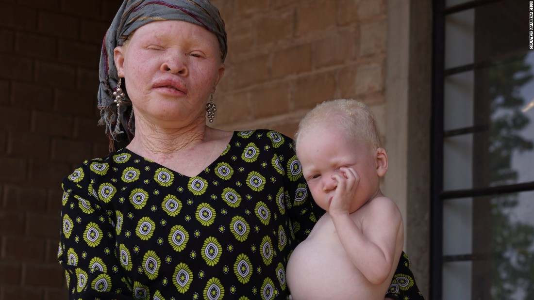 Songs From Tanzania S Island Of Albinos CNN